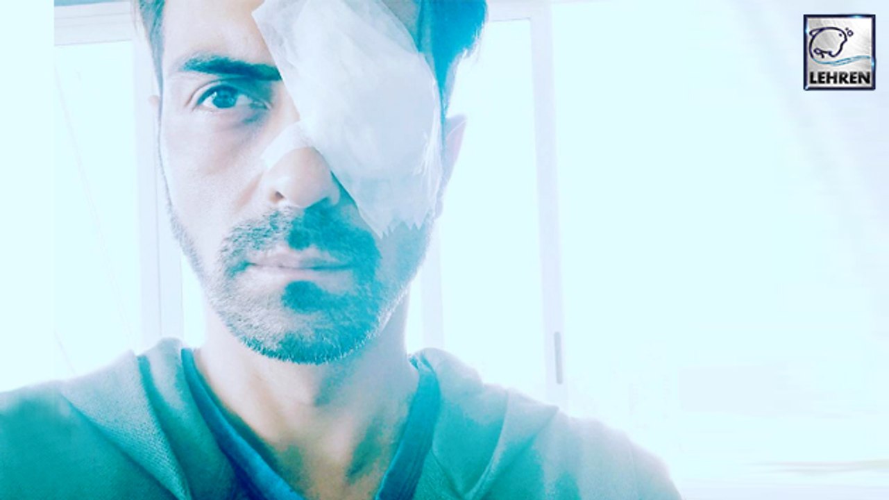 Arjun Rampal Suffers From Eye Injury