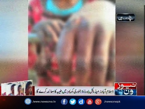 Medical board constituted to examine allegedly tortured child maid