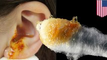 Put the Q-tips down! Earwax is good for you and cleaning it could lead to problems, doctors say