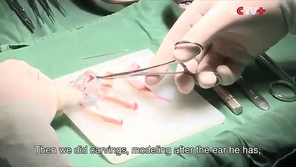 Chinese doctor grows ear on man's ARM to restore