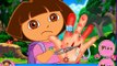 Dora hand surgery game , nice game for childrens , fun game for childrens , best game for child , su
