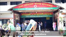 Hope for Bangladesh 'Tree Man' after multiple operations