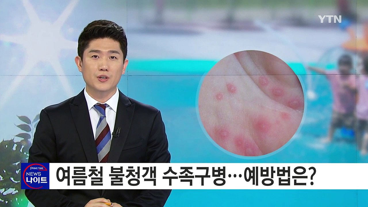 여름철 불청객 수족구병...예방법은? / YTN (Yes! Top News)