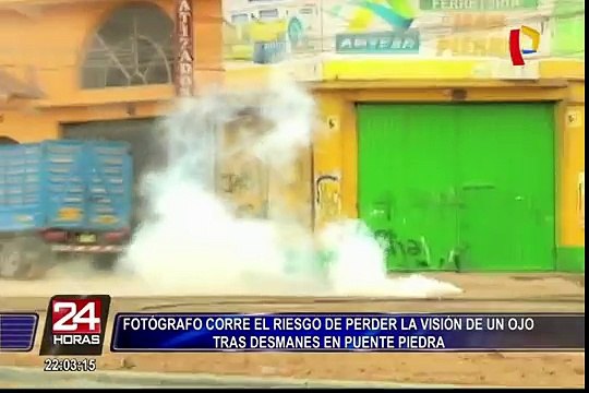 Fotógrafo corre el riesgo de perder la visión de un ojo tras desmanes en Puente Piedra