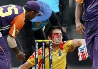 TOP 10 BRUTAL INJURIES IN CRICKET HISTORY   2016-17