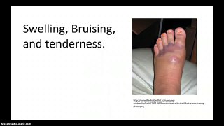 Possible Signs of a Broken Foot