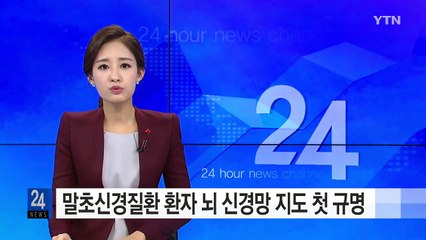 유전성 말초신경질환 환자의 뇌 신경망 지도 첫 규명 / YTN (Yes! Top News)