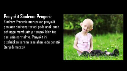 Penyakit Aneh Dan Mengerikan Yang Jarang Diketahui