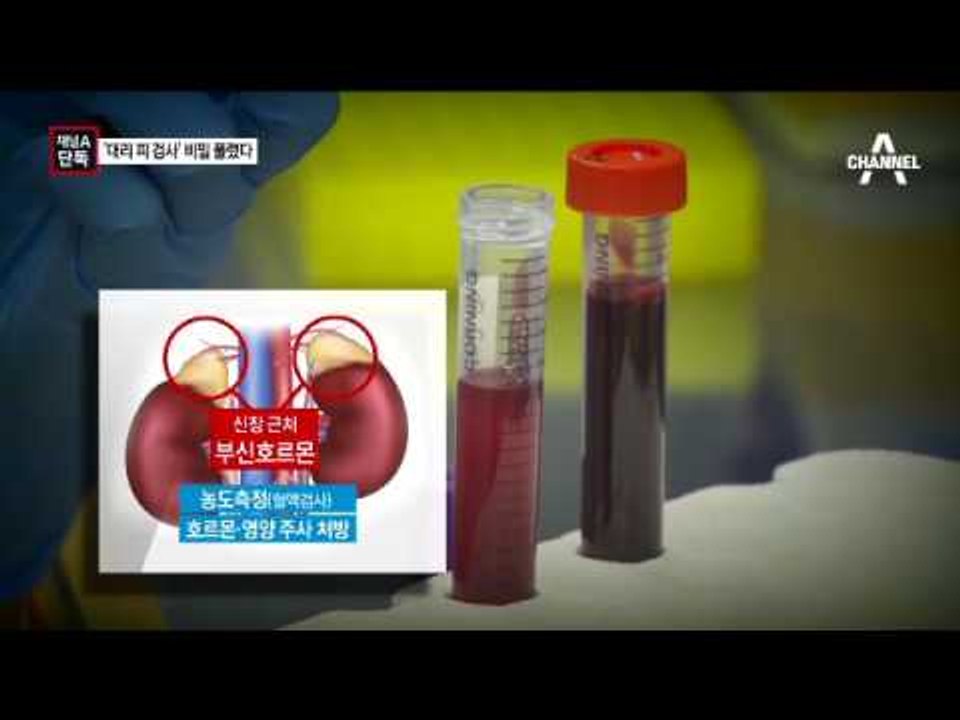 [채널A단독]‘박 대통령, 대리 피 검사’ 비밀 풀렸다
