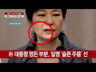 [3차 청문회] 김영재, "박근혜 피멍, 필러" 증언하다 '말 바꾸기