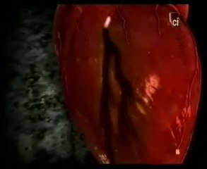 Crack (Cocaina): Autopsia forense