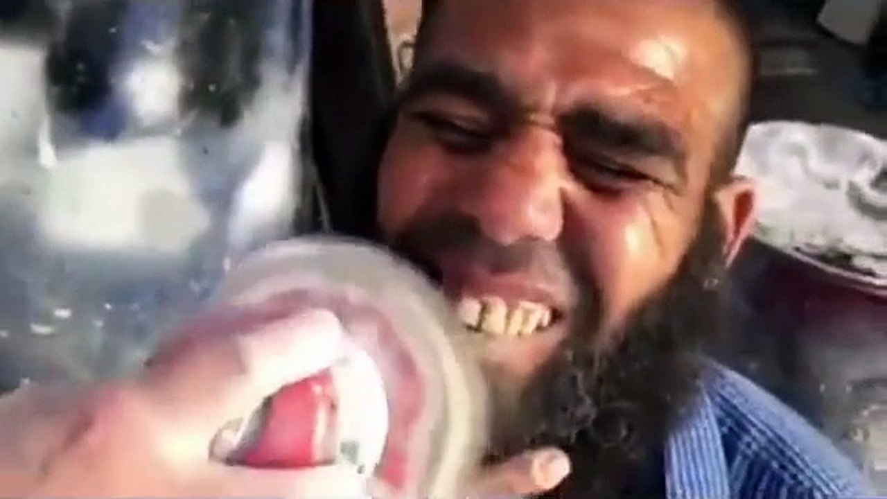 Homem mostra como consegue branquear os dentes de forma rápida e barata numa oficina... WTF!