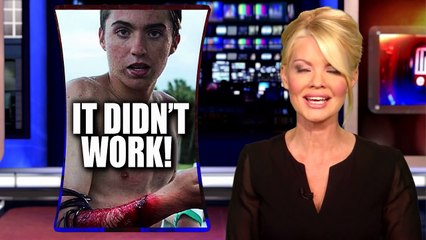 Teen Surfer Survives Shark Attack Despite Wearing Band Meant To Repel Them-NzhHZssTUug