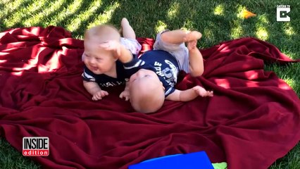 Mother Of Rare Twins With Down Syndrome Admits She Wanted To Give Them Up-uOifNAELs_U