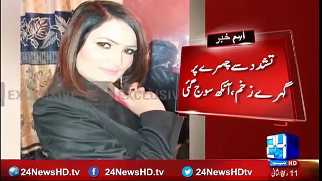 Pakistani Female Singer Tortured By Husband