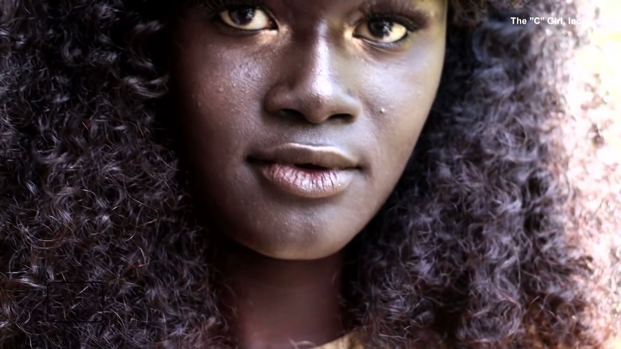 Woman Bullied As Child for Her Dark Completion Becomes Fashion Model-2z_EBFbmMOA