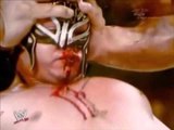 Rey Mysterio vs. The Great Khali HD Rey Mysterioalmost died