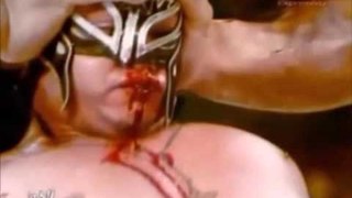 Rey Mysterio vs. The Great Khali HD Rey Mysterioalmost died