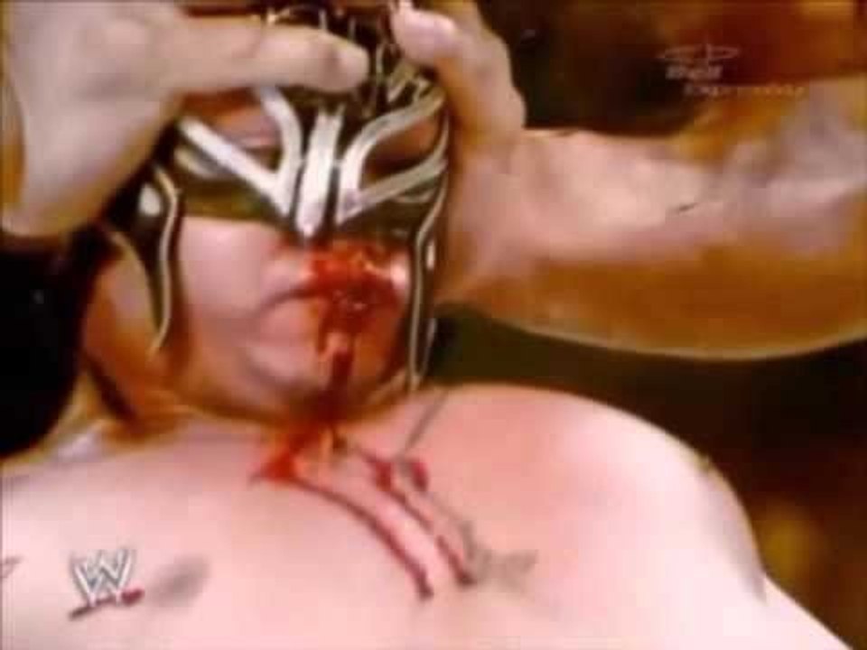 Rey Mysterio vs. The Great Khali HD Rey Mysterioalmost died