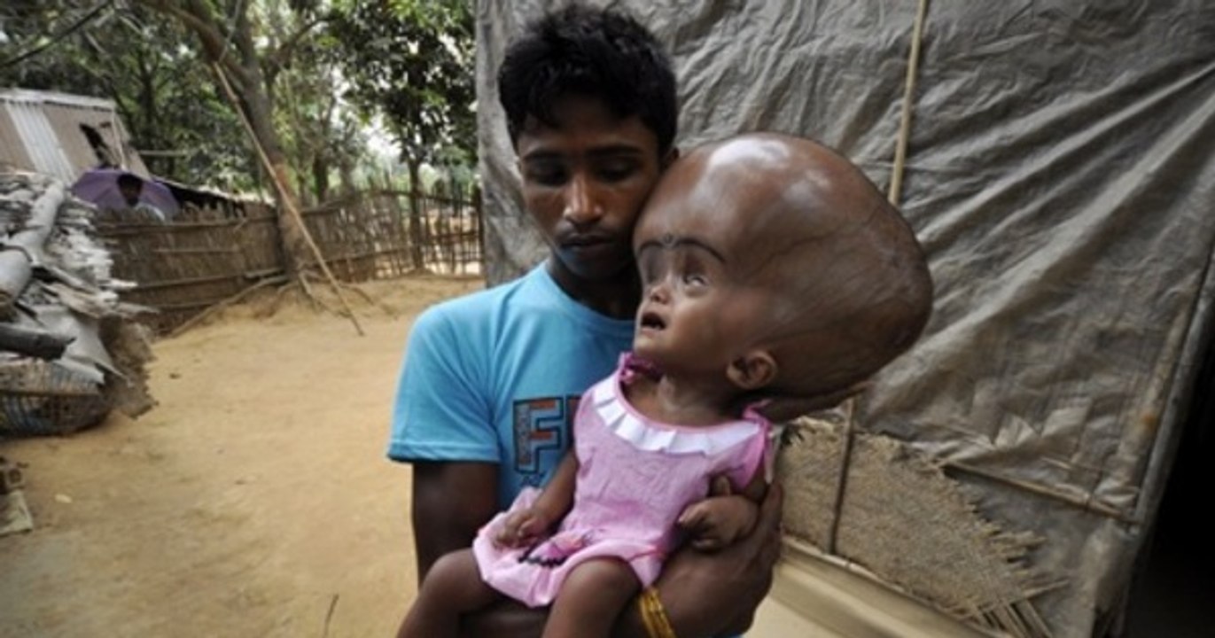 AS 5 ANOMALIAS MAIS BIZZARAS DO MUNDO