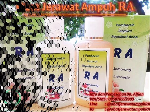 HP 0858 7859 2803 Obat Penyembuh Jerawat Batu Secara Alami dan Ampuh