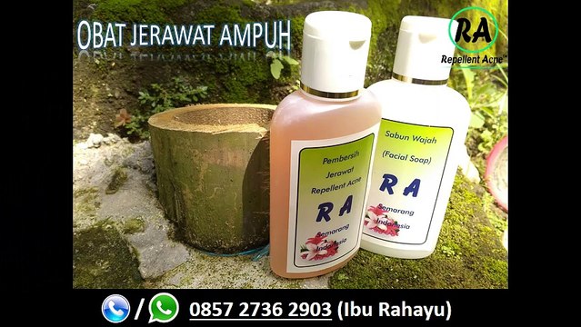 HP 0857 2736 2903, Obat Jerawat Ampuh Alami Dan Cepat