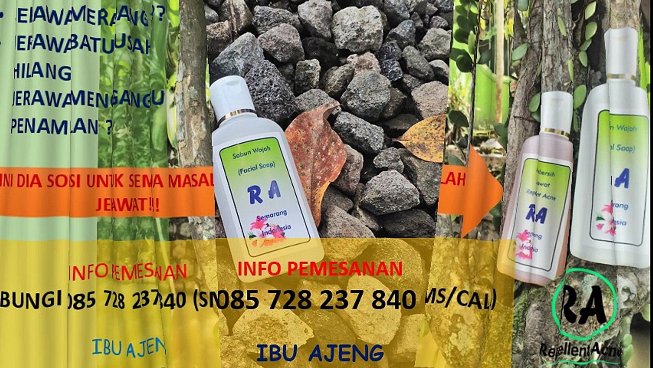 HP 085 728 237 840 Obat Jerawat Batu Yang Sudah Parah Yang Dijual Di Apotik