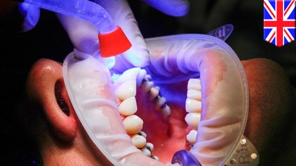 Alzheimer’s drug could regrow teeth without the need for fillings