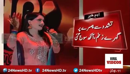 Pakistani Female Singer Tortured By Husband