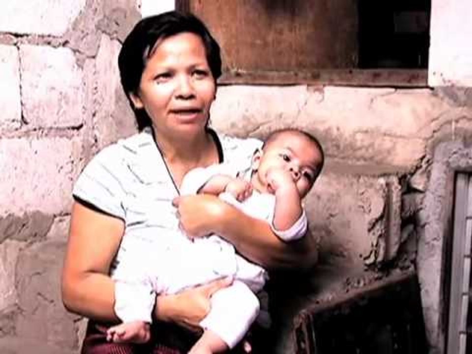 Pinoy MD: Chronic Kidney Disease and Eyelashes!