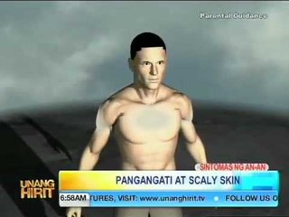 UH Kapuso sa Kalusugan: An-An Treatment!