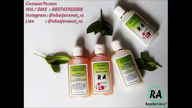 HP 0857 4393 3008 Obat Jerawat Alami Dan Paling Ampuh