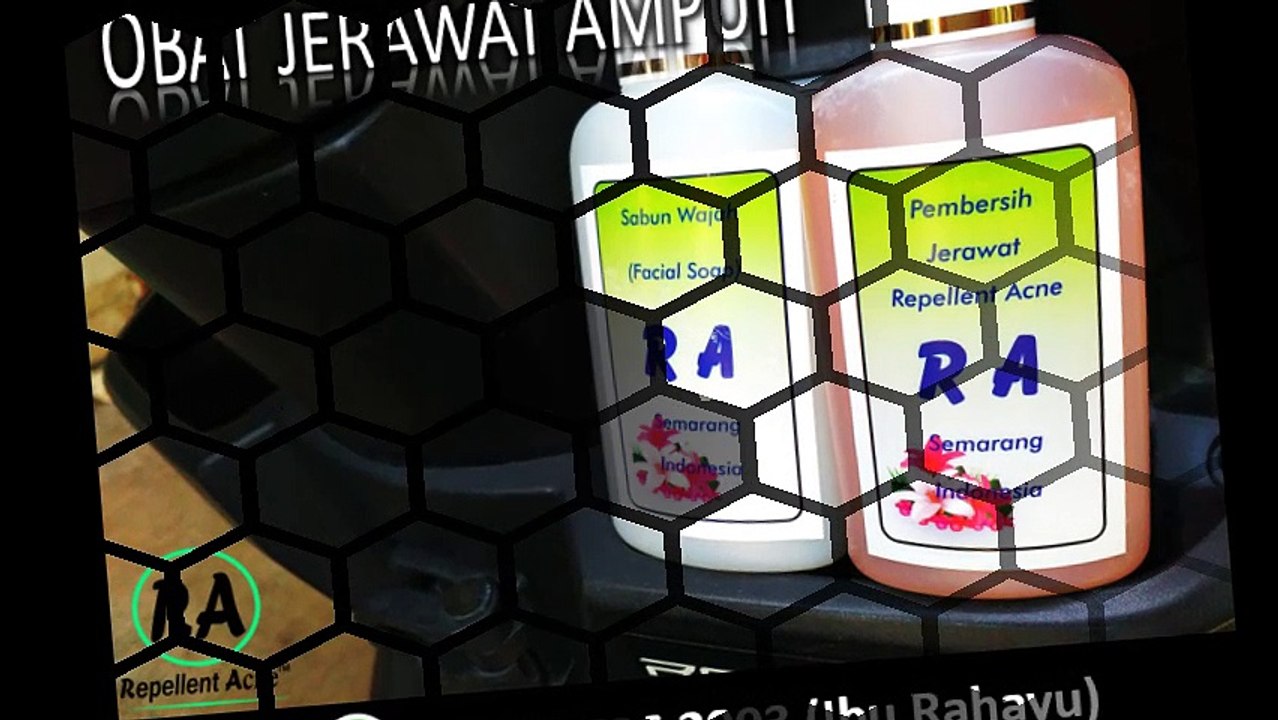 HP 0857 2736 2903, Obat Jerawat Ampuh Dan Alami
