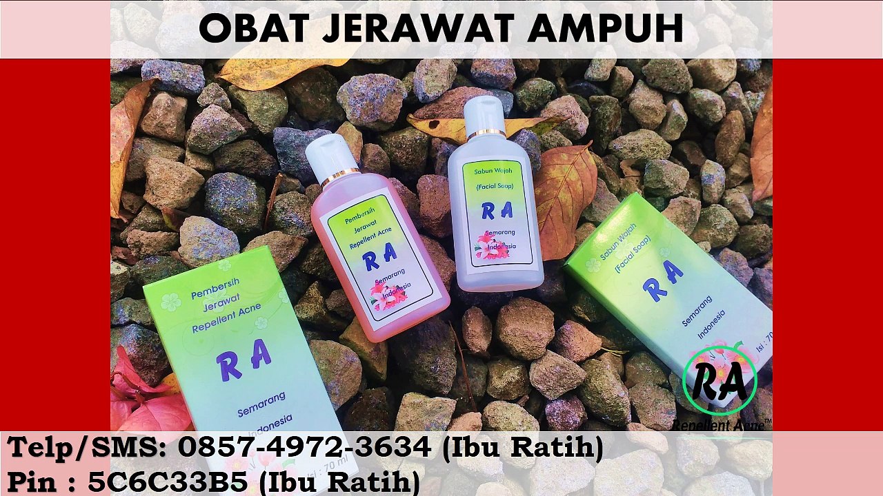 HP 085749723634 Obat Jerawat Paling Ampuh, Alami Untuk Pria
