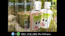 HP 0857 2736 2903, Obat Jerawat Ampuh Dan Aman Di Apotik