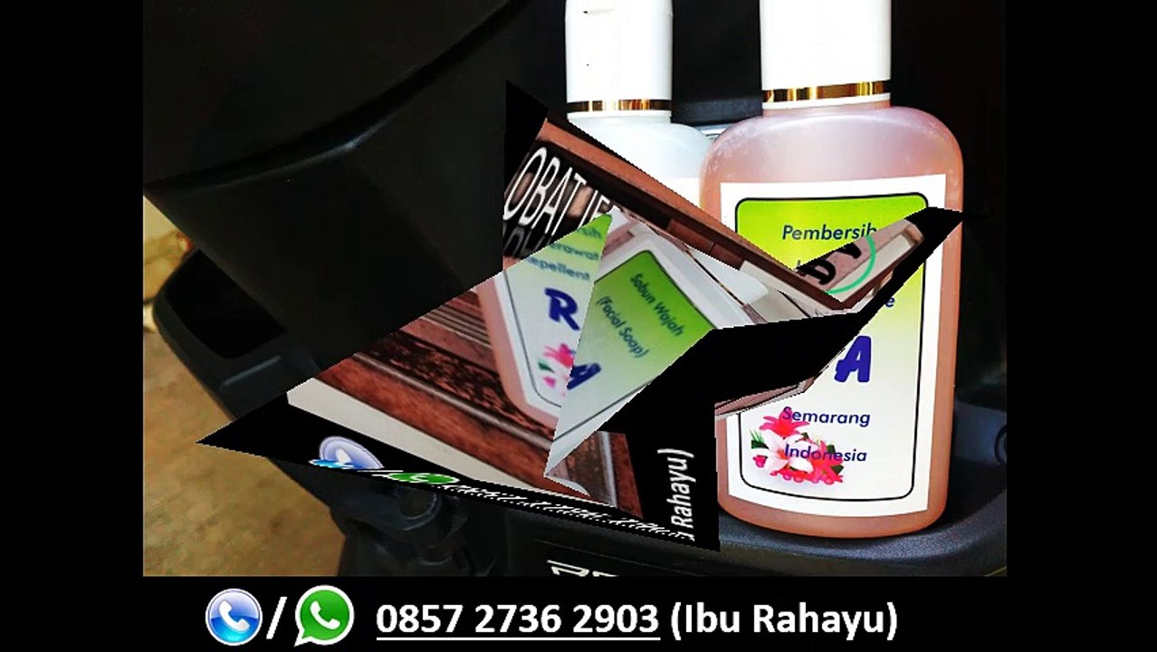HP 0857 2736 2903, Obat Jerawat Ampuh Dan Cepat Di Apotik