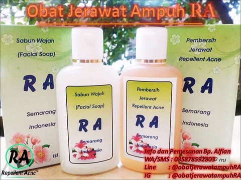 HP 0858 7859 2803 Obat Penyembuh Jerawat Batu Secara Alami dan Cepat