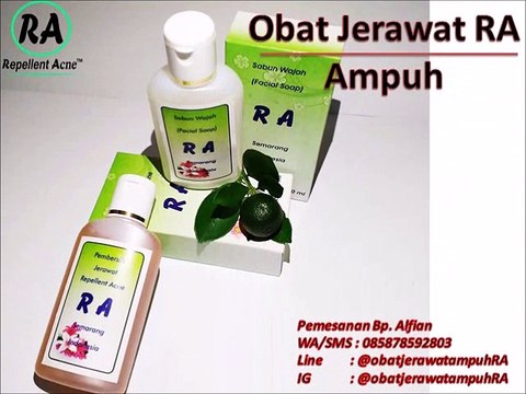 HP 0858 7859 2803 Obat Penyembuh Jerawat Paling Ampuh dan Cepat di Apotik