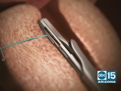 Affiliated Urologists talk about treatment for men with enlarged prostate