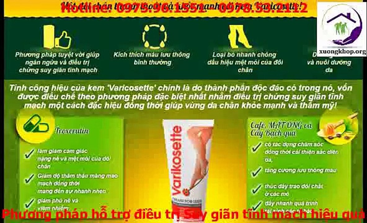Kem Varikosette - Hỗ trợ ngăn ngừa và điều trị chứng suy giãn tĩnh mạch