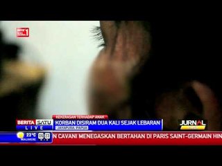 Anak 10 Tahun Disiram Air Panas oleh Ibu Tirinya