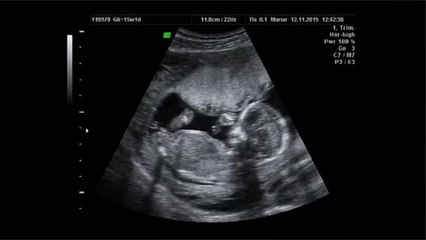 What is an Assisted Delivery?