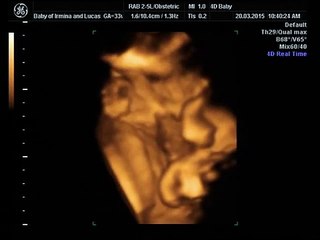 4d baby ultrasound scan at 33 weeks pregnant