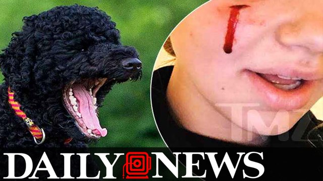 President Obama’s Dog Sunny Bites White House Visitor In The Face
