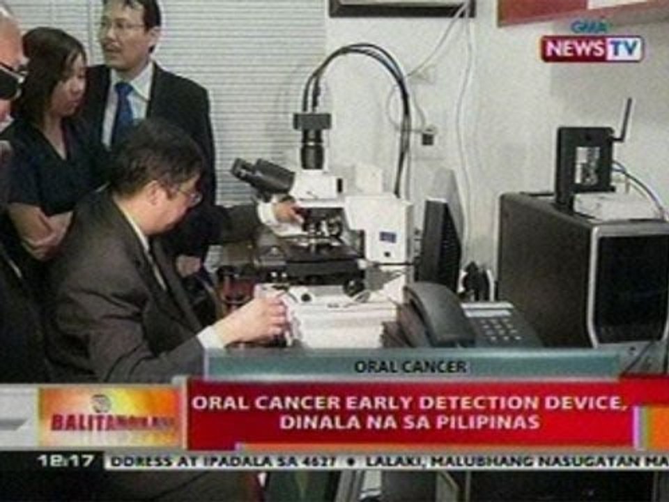 BT: Oral cancer early detecting  device, dinala na sa Pilipinas