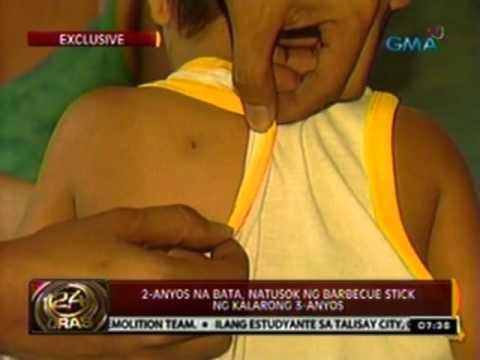 24 Oras: 2-anyos na bata, natusok ng barbeque stick ng kalarong 3-anyos