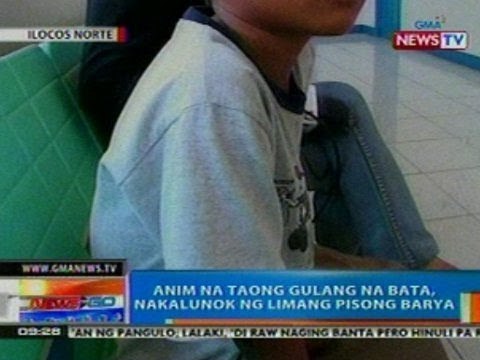 NTG: 6 na taong gulang na bata sa Ilocos Norte, nakalunok ng 5 pisong barya