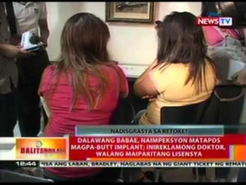 BT: Dalawang babae, naimpeksyon matapos magpa-butt implant