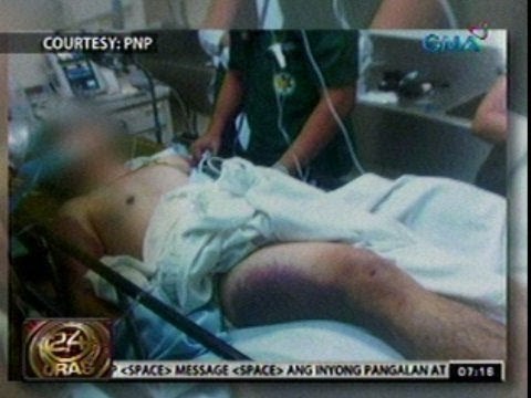 24 Oras: Biktima umano ng hazing victim na si Marc Andre Marcos, tadtad ng pasa sa katawan