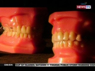 SONA: 3 sa kada 10 Pilipino, nakasuot ng pustiso